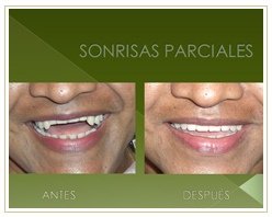 Slider image (8) Dr. Rojas Esthetique Dental Clinic